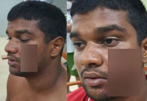 තරුණයෙකුට පහරදීමේ සිද්ධියට පෑලියගොඩ පොලිසියේ හතරකගේ වැඩ තහනම්