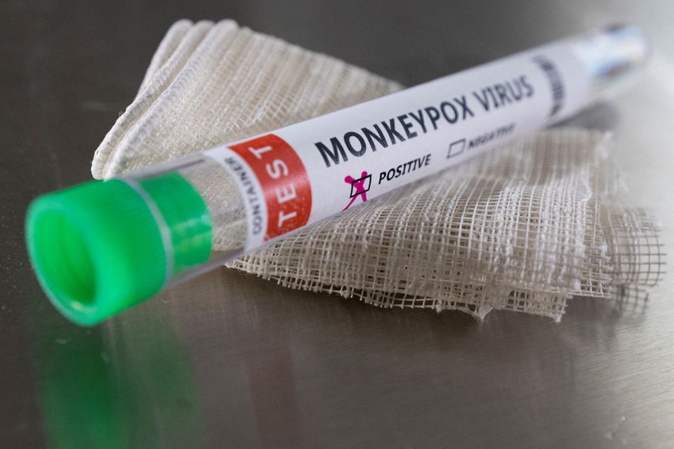 Monkeypox වෛරසය එංගලන්තයේත් පැතිරෙයි