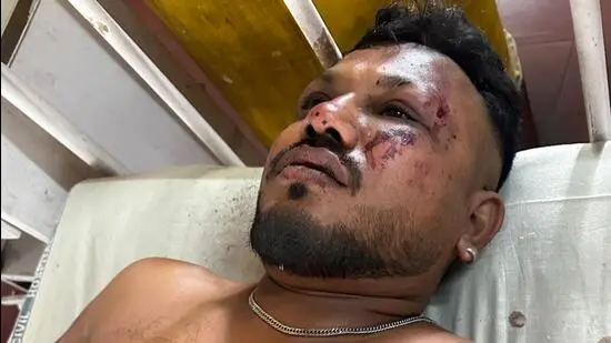 ගුවන් අනතුරින් එක මගියකුගේ දිවි බේරේ ගුවන් අනතුරින් එක මගියකුගේ දිවි බේරේ