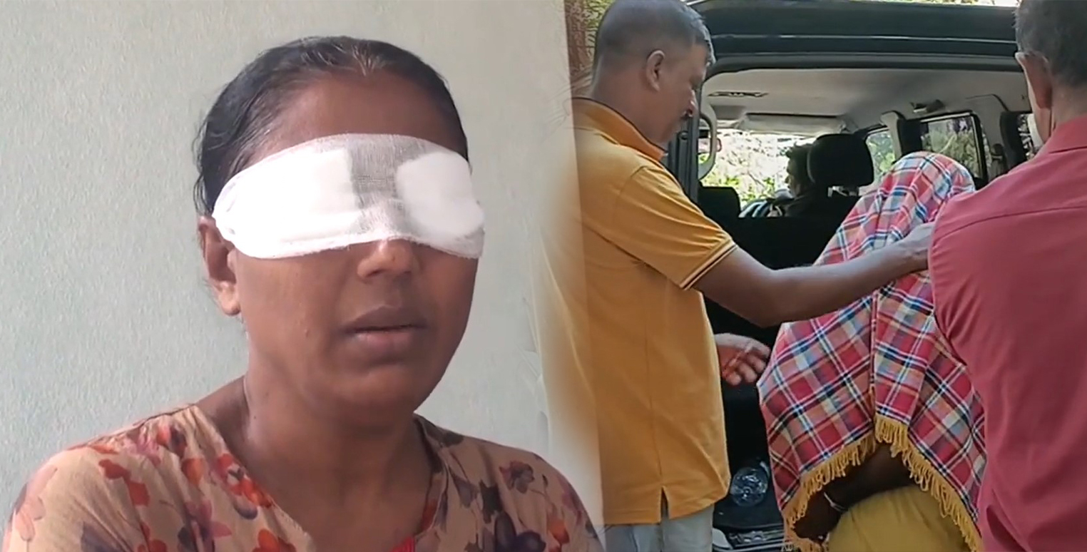 කුඩු වර්ගයක් ගසා කාන්තාවකගේ දෑස් අන්ධ කළ මංකොල්ලකරුවෙක් අත්අඩංගුවට කුඩු වර්ගයක් ගසා කාන්තාවකගේ දෑස් අන්ධ කළ මංකොල්ලකරුවෙක් අත්අඩංගුවට